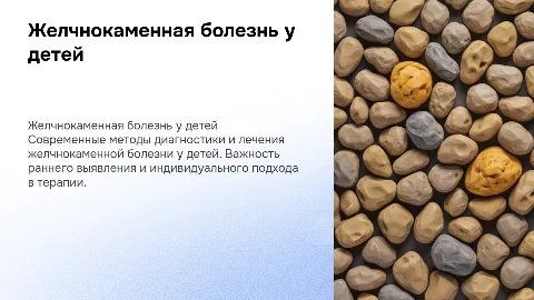 Желчнокаменная болезнь у детей: современные подходы к лечению