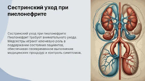 Сестринский уход за пациентами при пиелонефрите