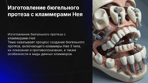 Изготовление бюгельного протеза с кламмерами Нея 3 типа