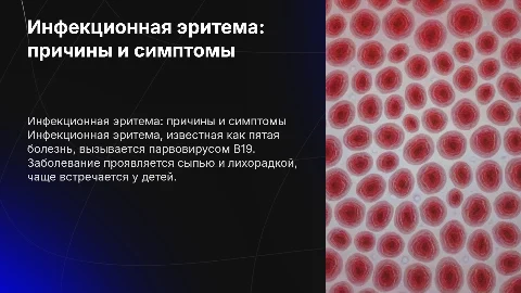 Инфекционная эритема