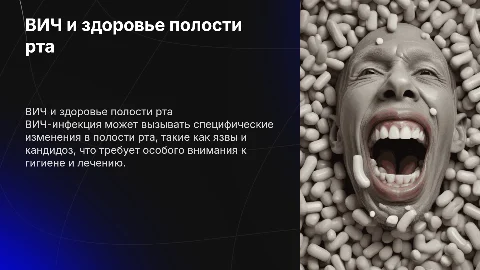 ВИЧ-инфекции. Особенности проявления в полости рта