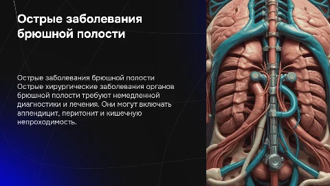 Острые хирургические заболевания органов брюшной полости