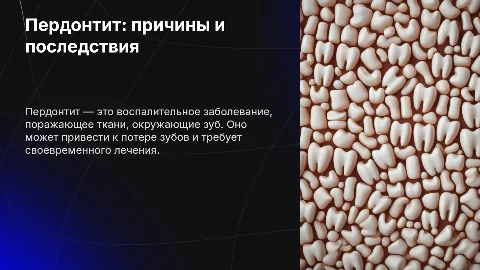 Пародонтит