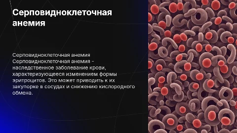 Серповидноклеточная анемия