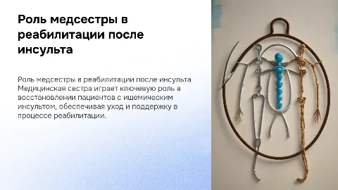 Роль медицинской сестры в реабилитации пациентов с инсультом