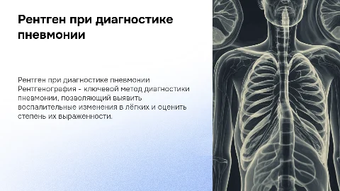 ренген при пневмонии