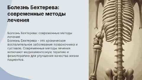 Болезнь Бехтерева. Современные методы лечения