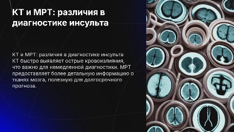 отличие КТ и МРТ в диагностике геморрагичсекого инсульта