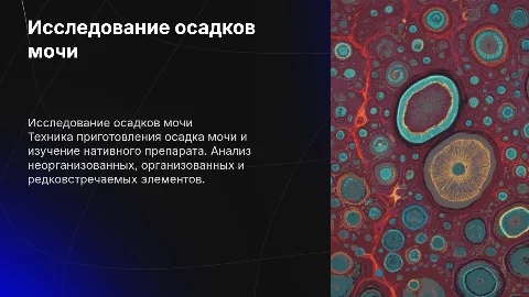 Исследование осадков мочи: техника и анализ нативного препарата