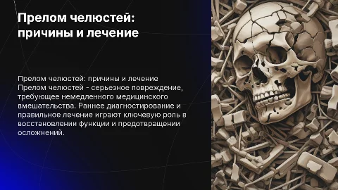 Прелом челюстей