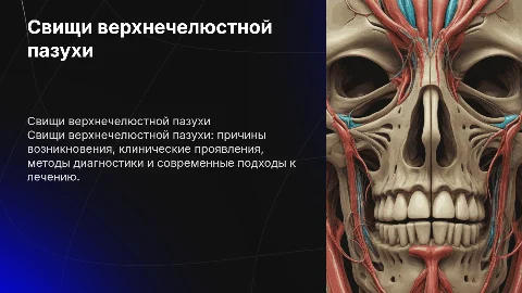 Свищи верхнечелюстной пазухи: этиология, клиника и лечение
