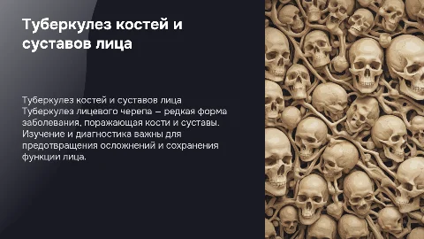 Туберкулез костей и суставов лицевого черепа