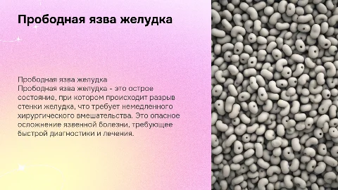 презентация по факультетской хирургии на тему прободная язва желудка