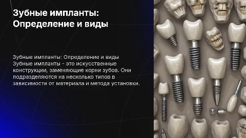 Зубные импланты : Определение и классификации