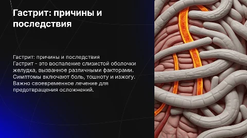 Гастрит