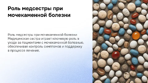 Роль медицинской сестры при уходе за пациентом с мочекаменной болезнью