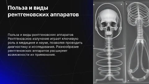 Польза рентгеновского излучения для человека и аппараты