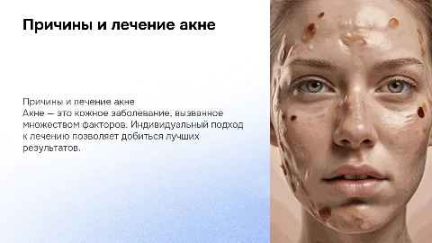 Причины возникновения акне и индивидуальный подход в лечении