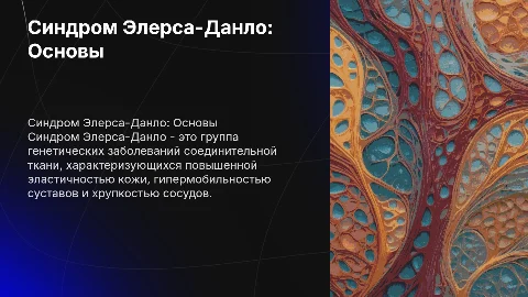 Синдром Элерса-Данло