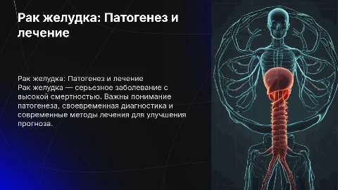 Рак желудка: Патогенез, диагностика и лечение