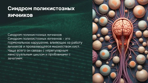 синдром поликистозных яичников