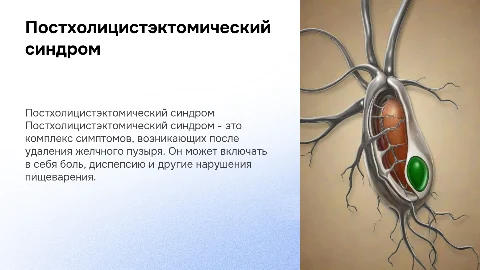 Постхолицистэктомический синдром
