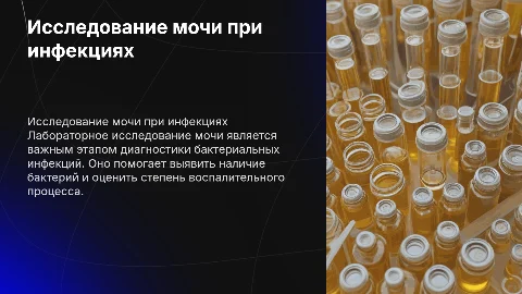 Лабораторное исследование мочи при бактериальной инфекции