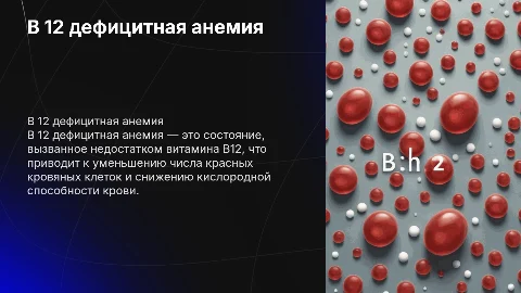B 12 дефицитная анемия