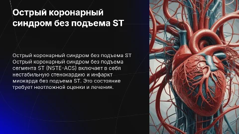 Острый коронарный синдром без подъема сегмента ST