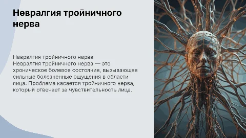 Невралгия тройничного нерва