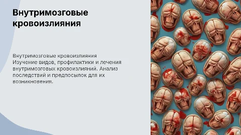 Внутримозговые кровоизлияния: виды, профилактика и лечение