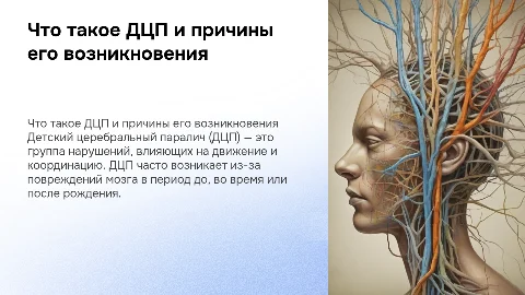 что такое дцп и от чего появляется