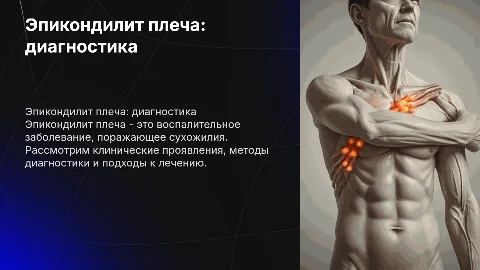 Эпикондилит плеча. Клиника, диагностика, лечение