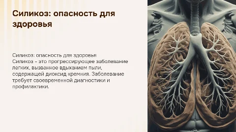 Cиликоз