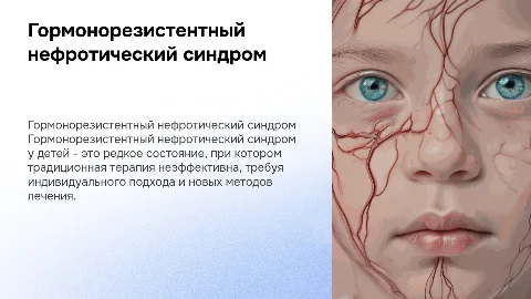 Тема: Гормонорезистентный нефротический синдром у детей