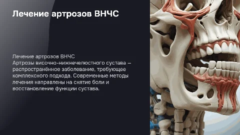 лечение артрозов внчс