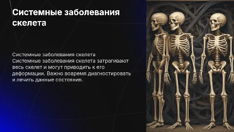 системные заболевания скелета