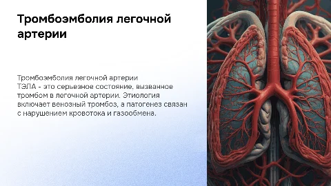 ТЭЛА: этиология, патогенез, клиника