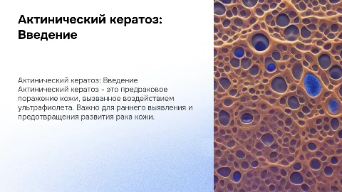 Актинический кератоз