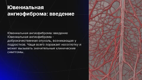 Ювениальная ангиофиброма