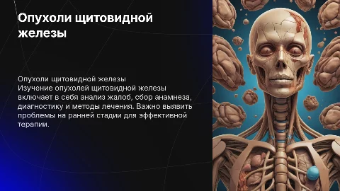 Опухоли щитовидной железы: диагностика и лечение