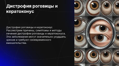 без картинок нейросети Дистрофия роговицы глаза и кератоконус