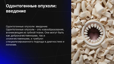 Одонтогенные опухоли