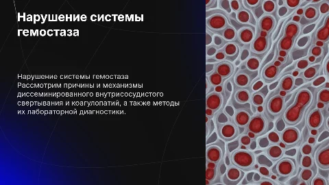 Нарушение системы гемостаза и коагулопатии: диагностика