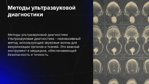 Методы ультразвуковой диагностики