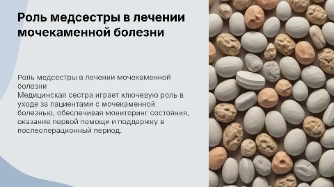 Роль медицинской сестры при помощи пациентам с мочекаменной болезнью