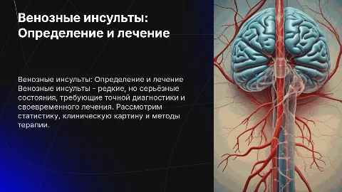 Венозные инсульты: диагностика и лечение