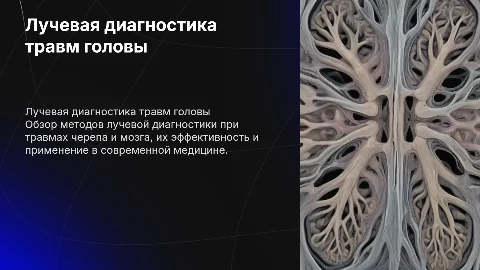Лучевая диагностика черепно-мозговых травм