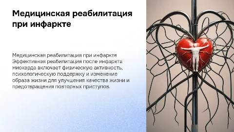 медицинская реабилитация при инфаркте миокарда