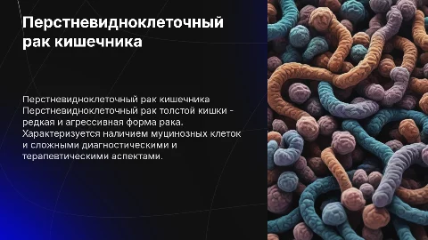 Перстневидноклеточный рак Толстой кишки